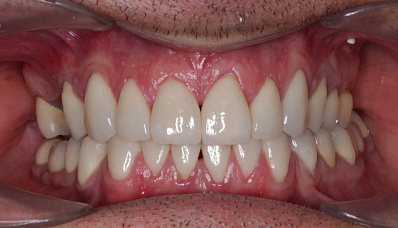 Пациент 36