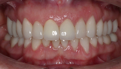 Пациент 38